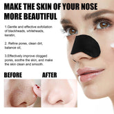 Sweet Face Nose Strip Deep Cleansing - YehChez.pk